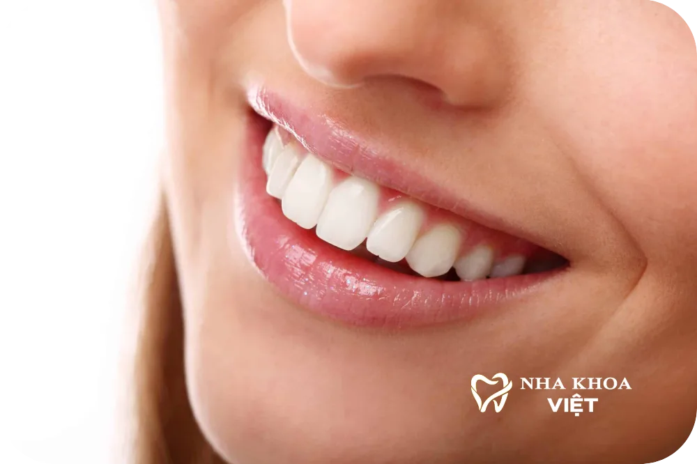 Nha khoa Việt - Tỏa sáng nụ cười Việt